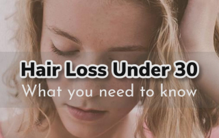 Hair Loss Under 30