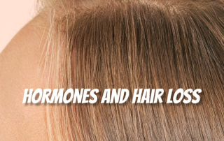 Hormones and Hair Loss