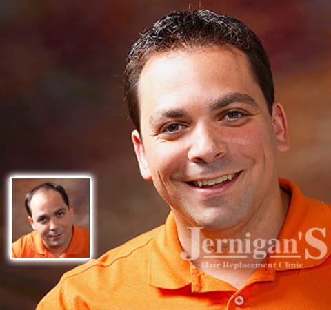 Jernigan’s Hair Replacement Clinic