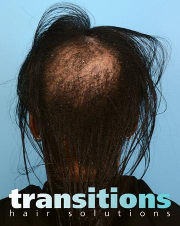 Transitions Hair Solutions