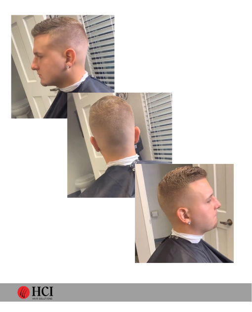 HCI Hair Solutions Before and After Gallery