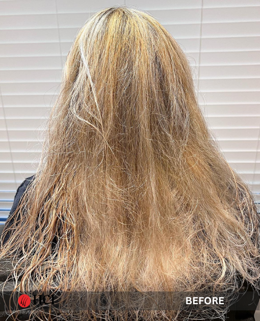 HCI Hair Solutions Before and After Gallery
