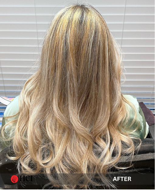 HCI Hair Solutions Before and After Gallery