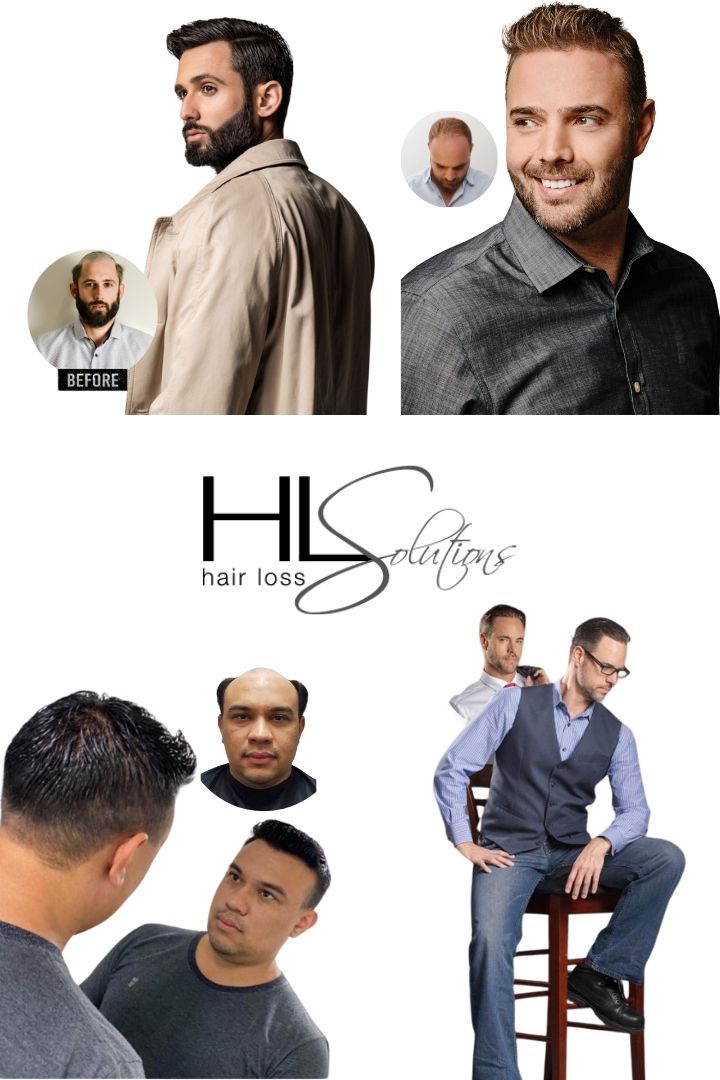 Hair Loss Solutions Gallery