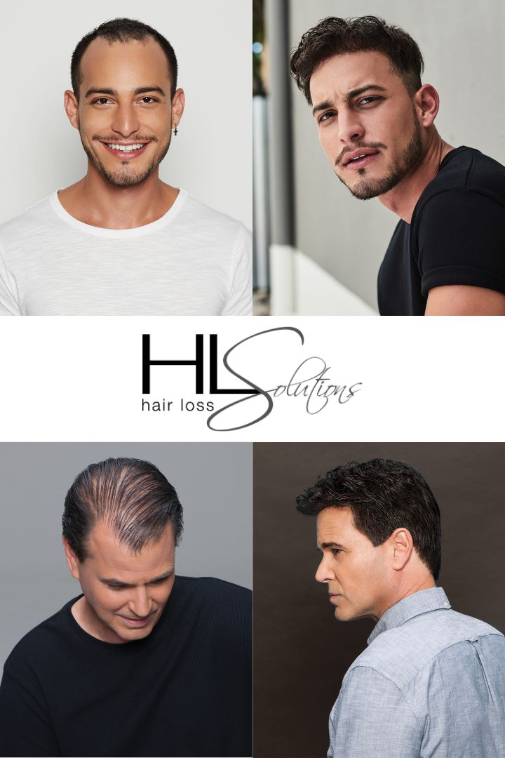 Hair Loss Solutions Gallery