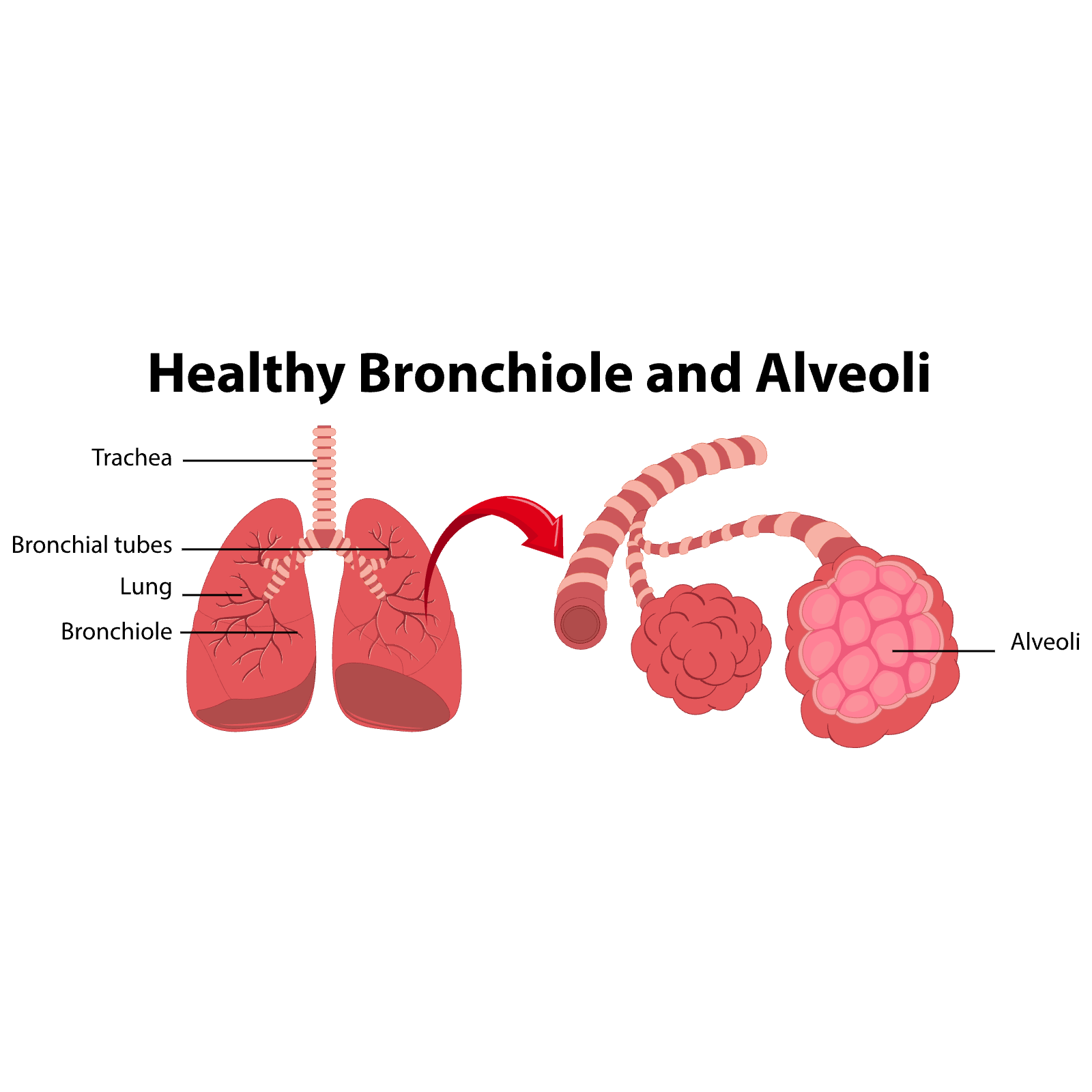 Healthy Bronchiole and Alveoli Diagram