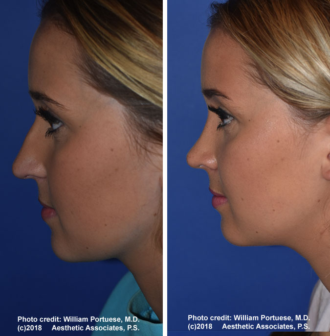 top facial Cosmetic surgeon