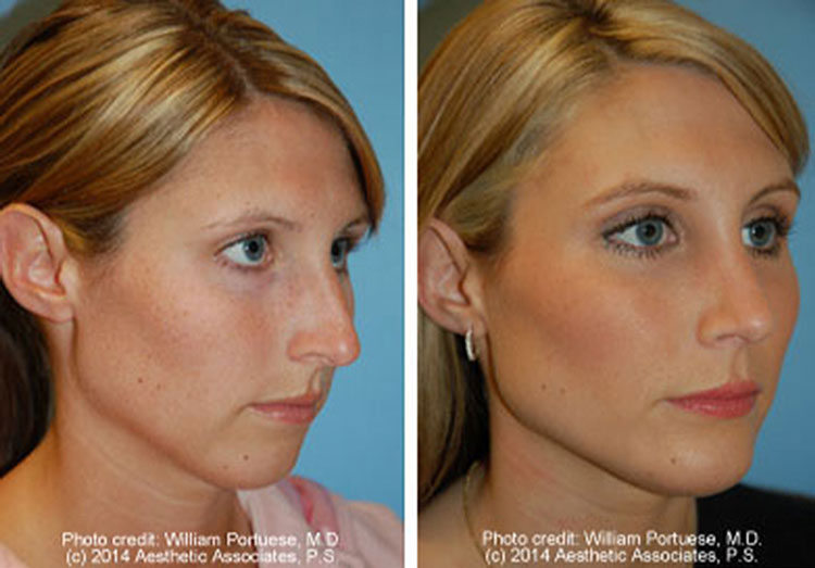 facial plastic surgeons near me