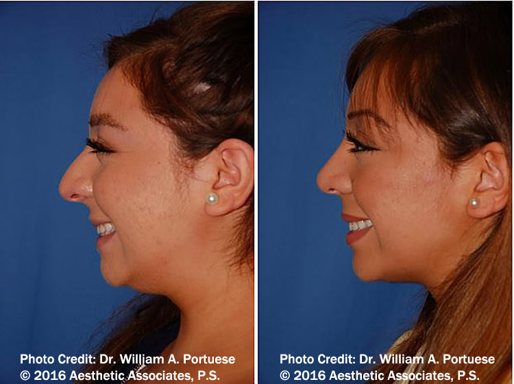 top facial plastic surgeon