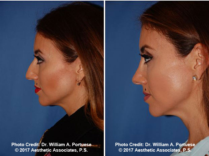 plastic surgery seattle wa