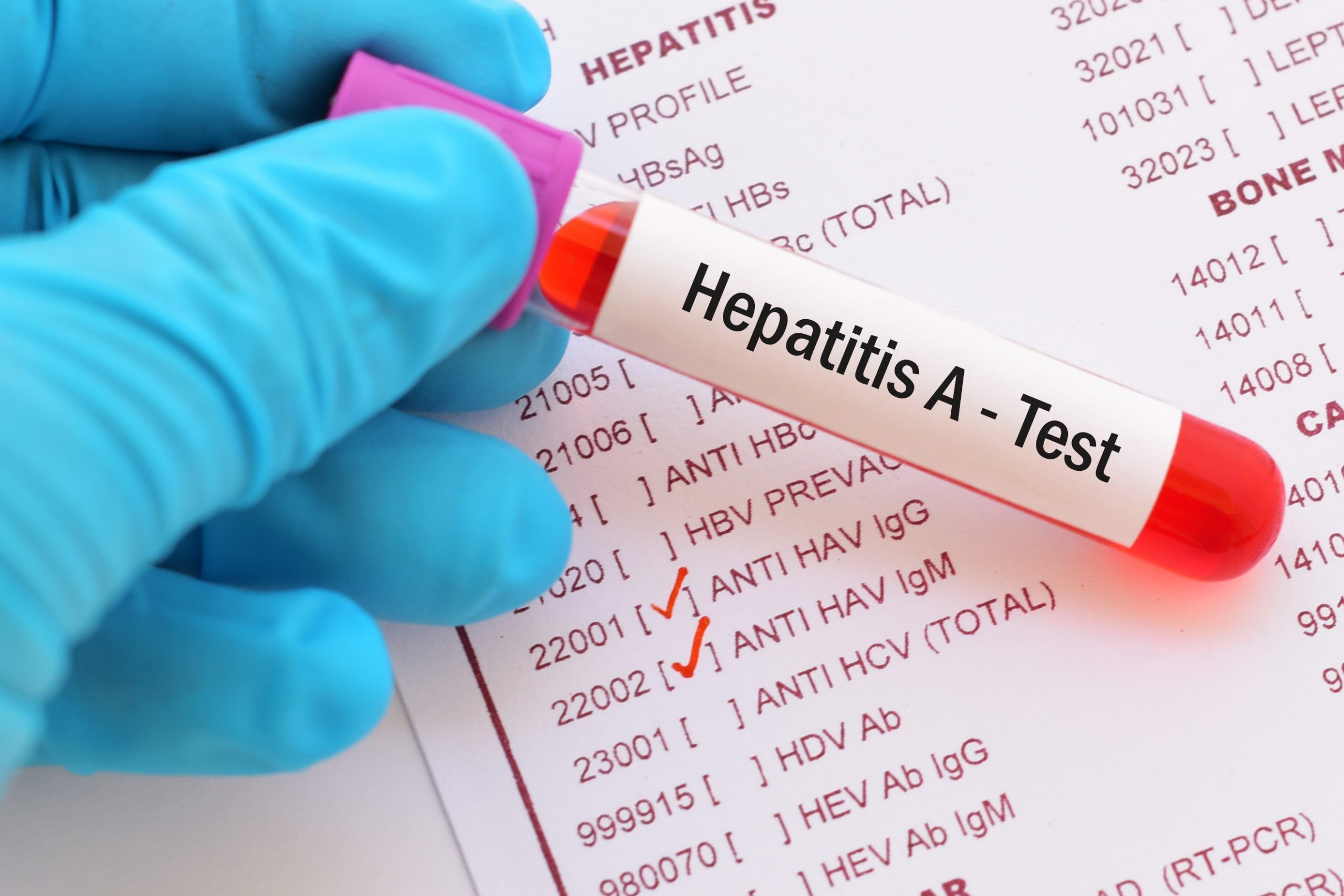 The Early Signs of Hepatitis