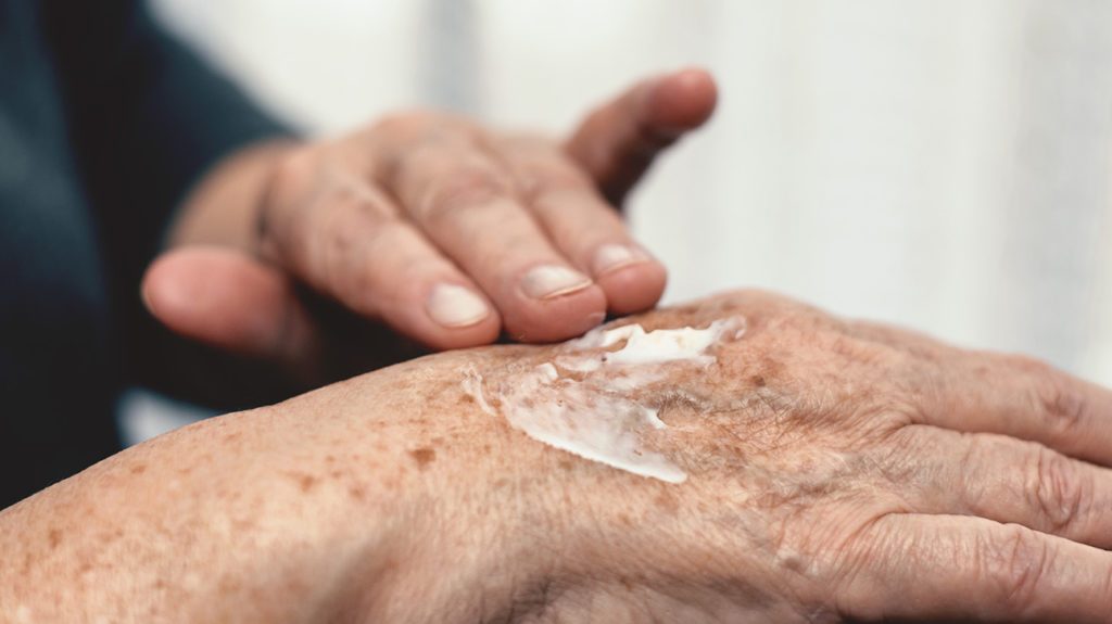 Effective Over-the-Counter Creams for Treating Arthritis