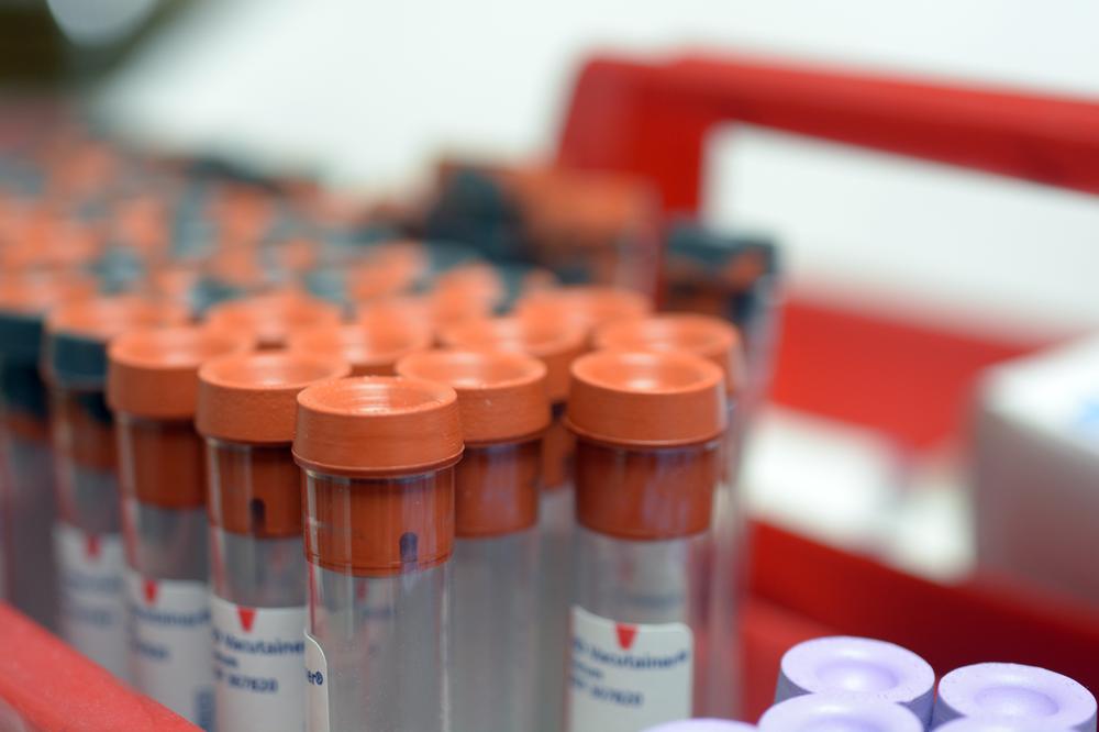 Allergy Testing Pittsburgh, PA & Pittsburgh, PA Genesis Medical Allergy Testing Pittsburgh, PA & Pittsburgh, PA Genesis Medical