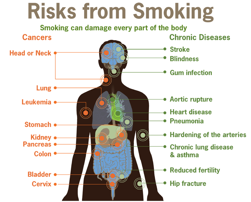 800px-Risks_form_smoking-smoking_can_damage_every_part_of_the_body.png