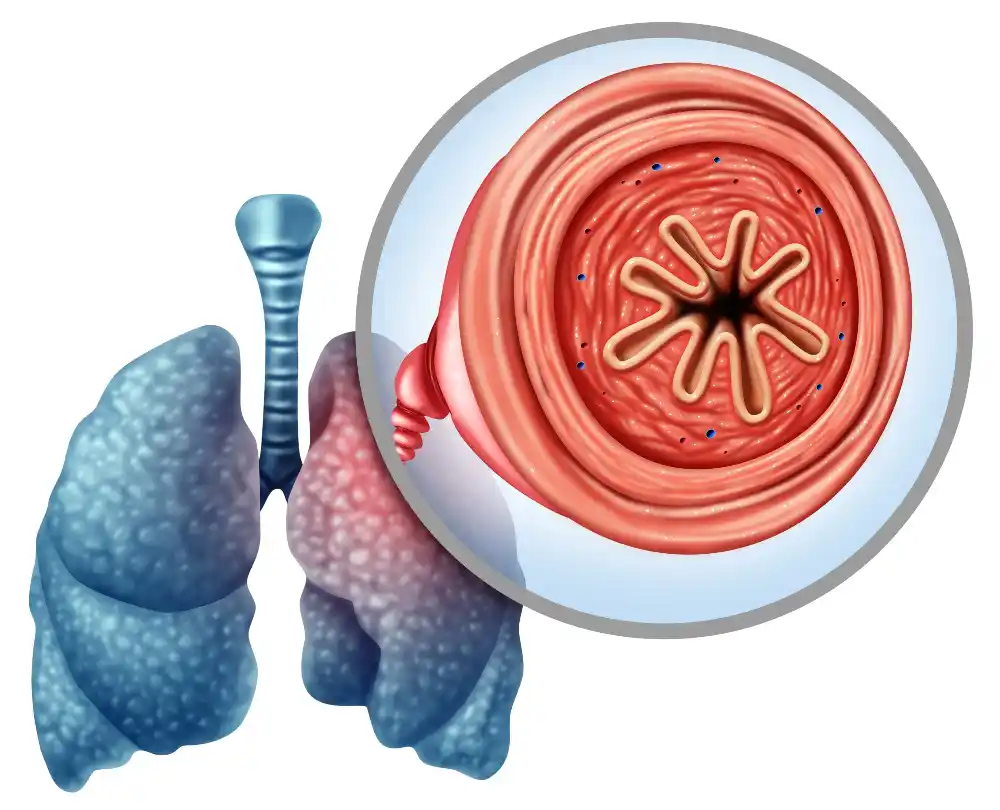 COPD Lungs