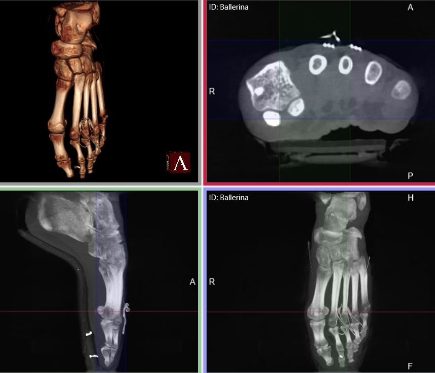 Standing Ct Scans Of Foot And Ankle Injuries Now Part Of Prisk Orthopaedics And Wellness Prisk Orthopaedics And Wellness