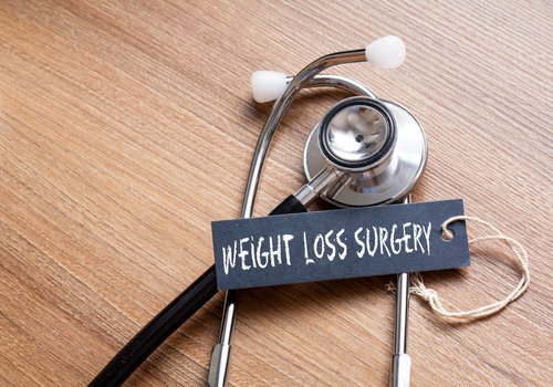 4 Must-Know Facts About Bariatric Surgery