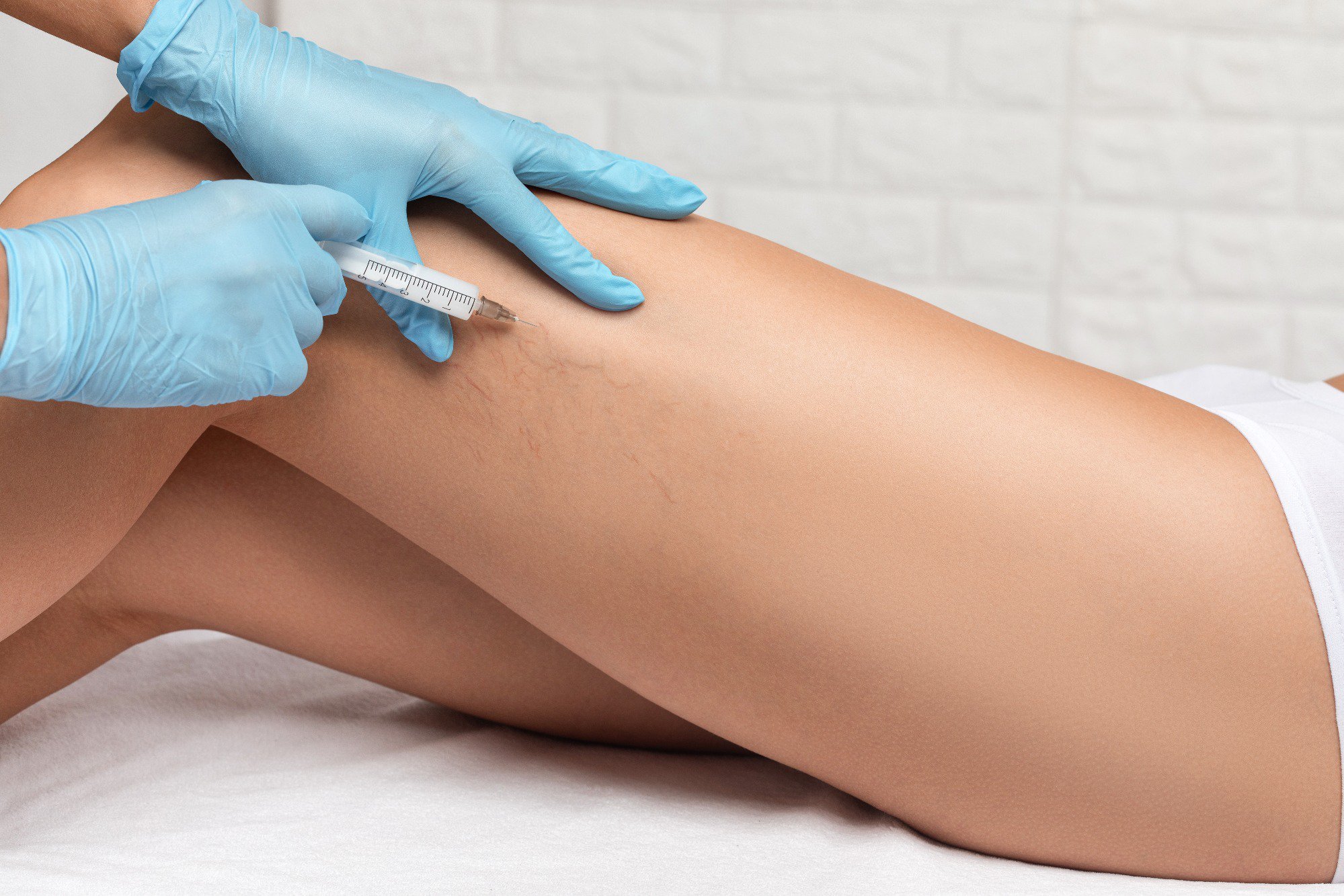 5 Benefits of Dermaplaning