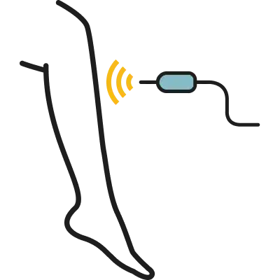 Endovenous Laser Ablation Icon