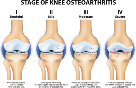 cartilage bone