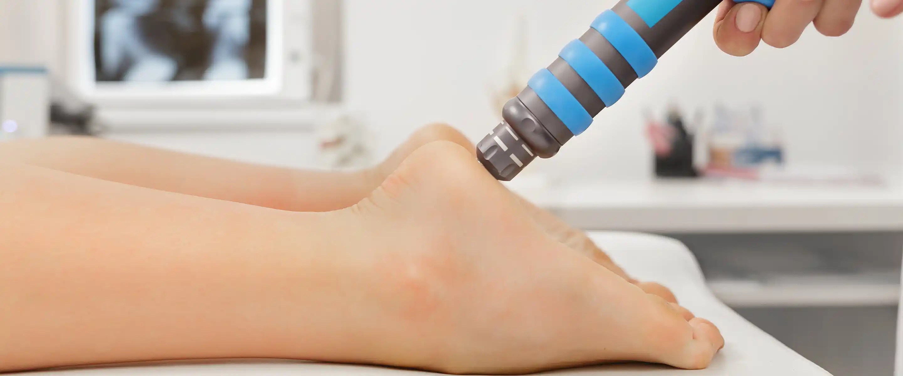 Shockwave Therapy for Plantar Fasciitis