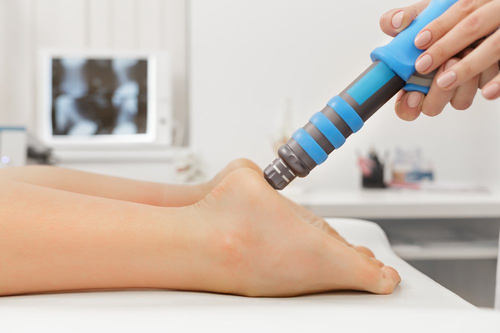 Shockwave Therapy Relieves Heel Spur Pain