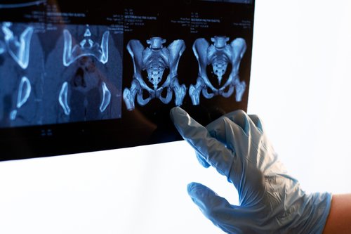 Also Viewed Blog Image