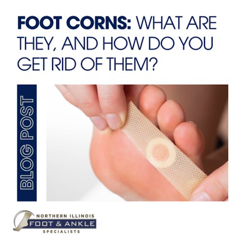 Foot Corns