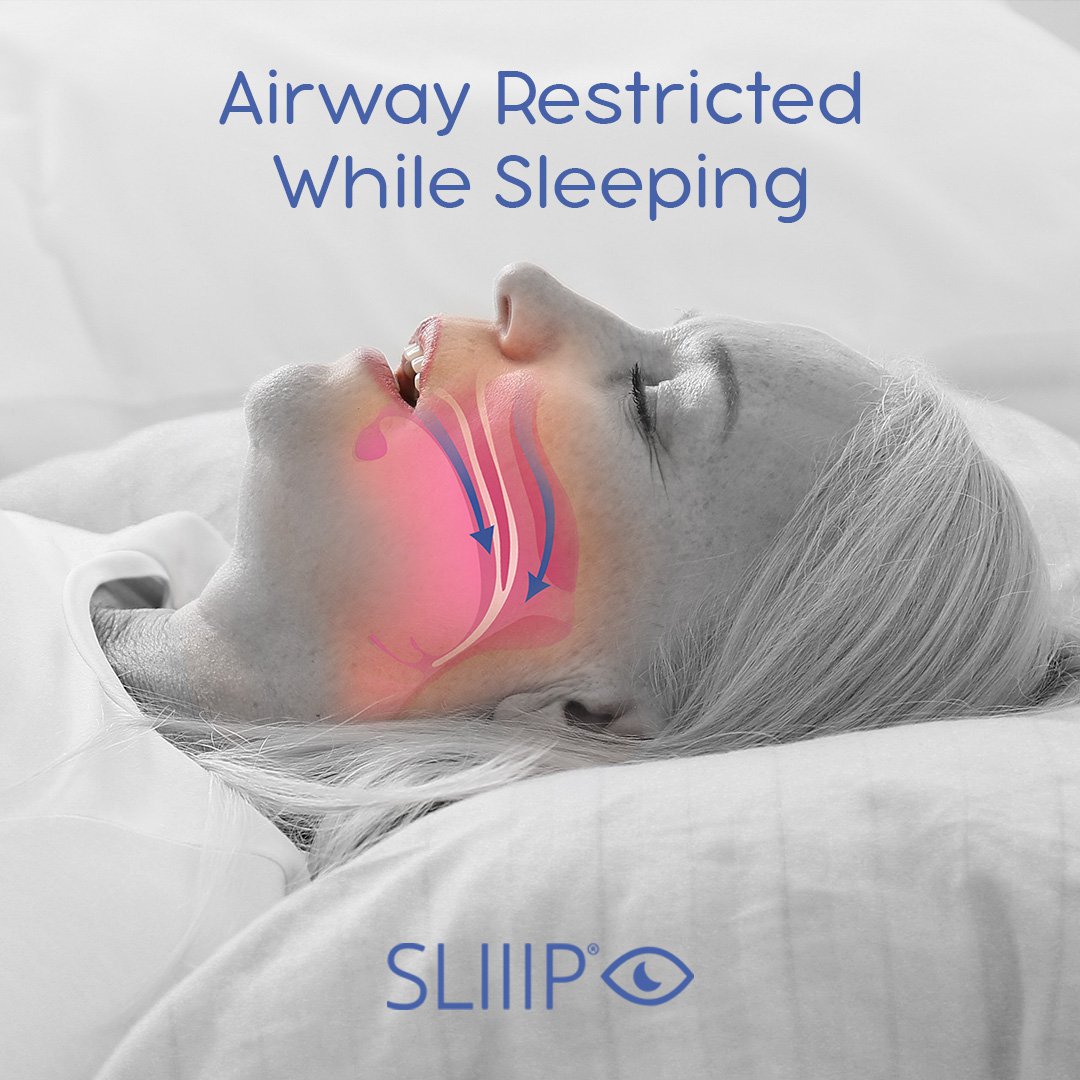 What is Obstructive Sleep Apnea? Causes, Symptoms, Risk Factors, and  Treatment Options -  Blog