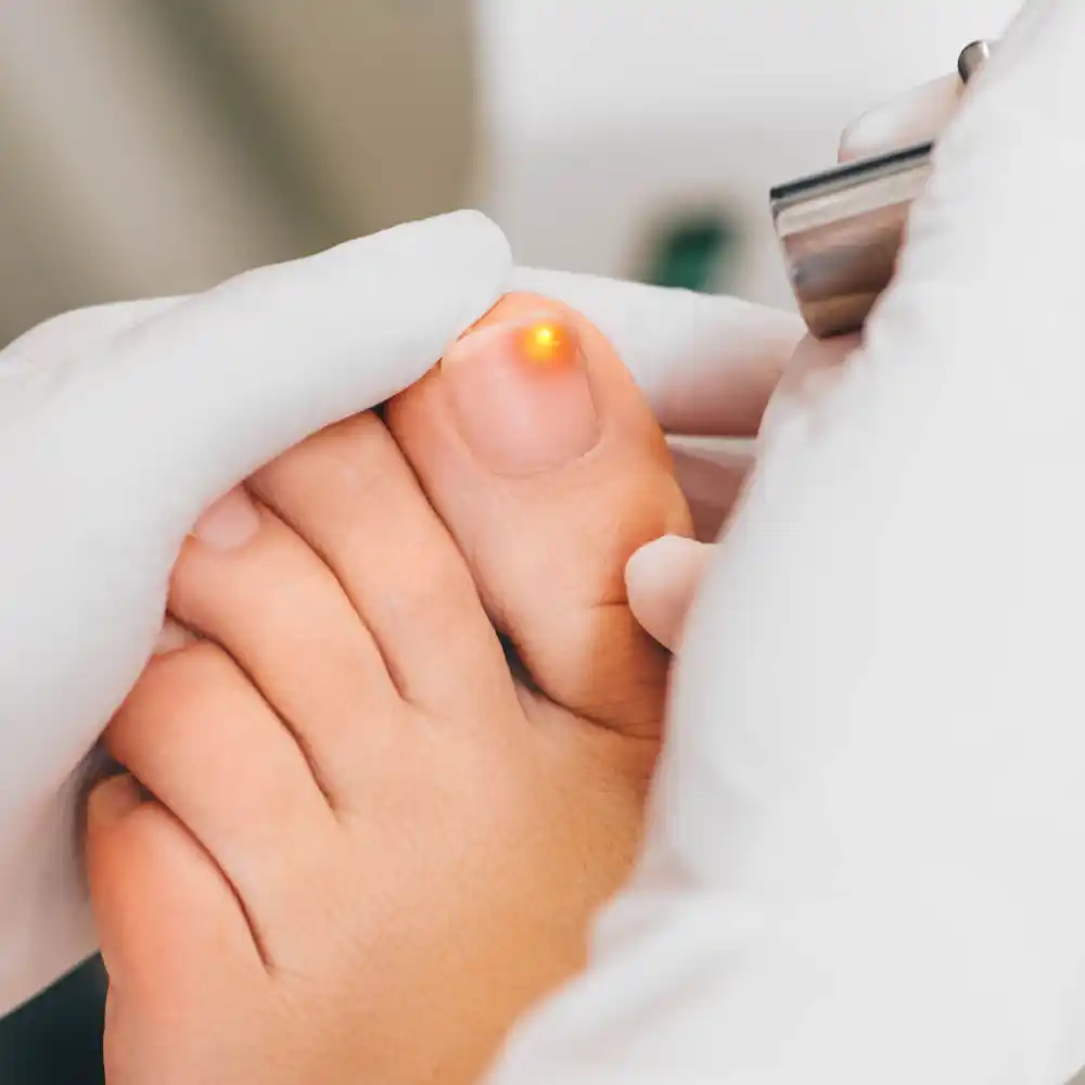 Ingrown Toenails: Foot Healers: Podiatrists