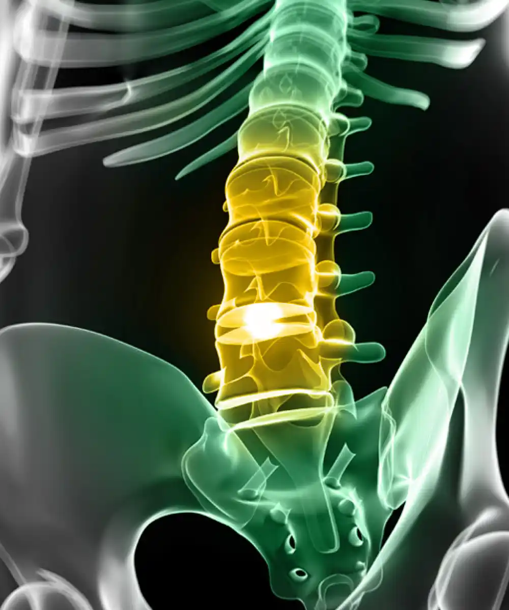 herniated disc x ray