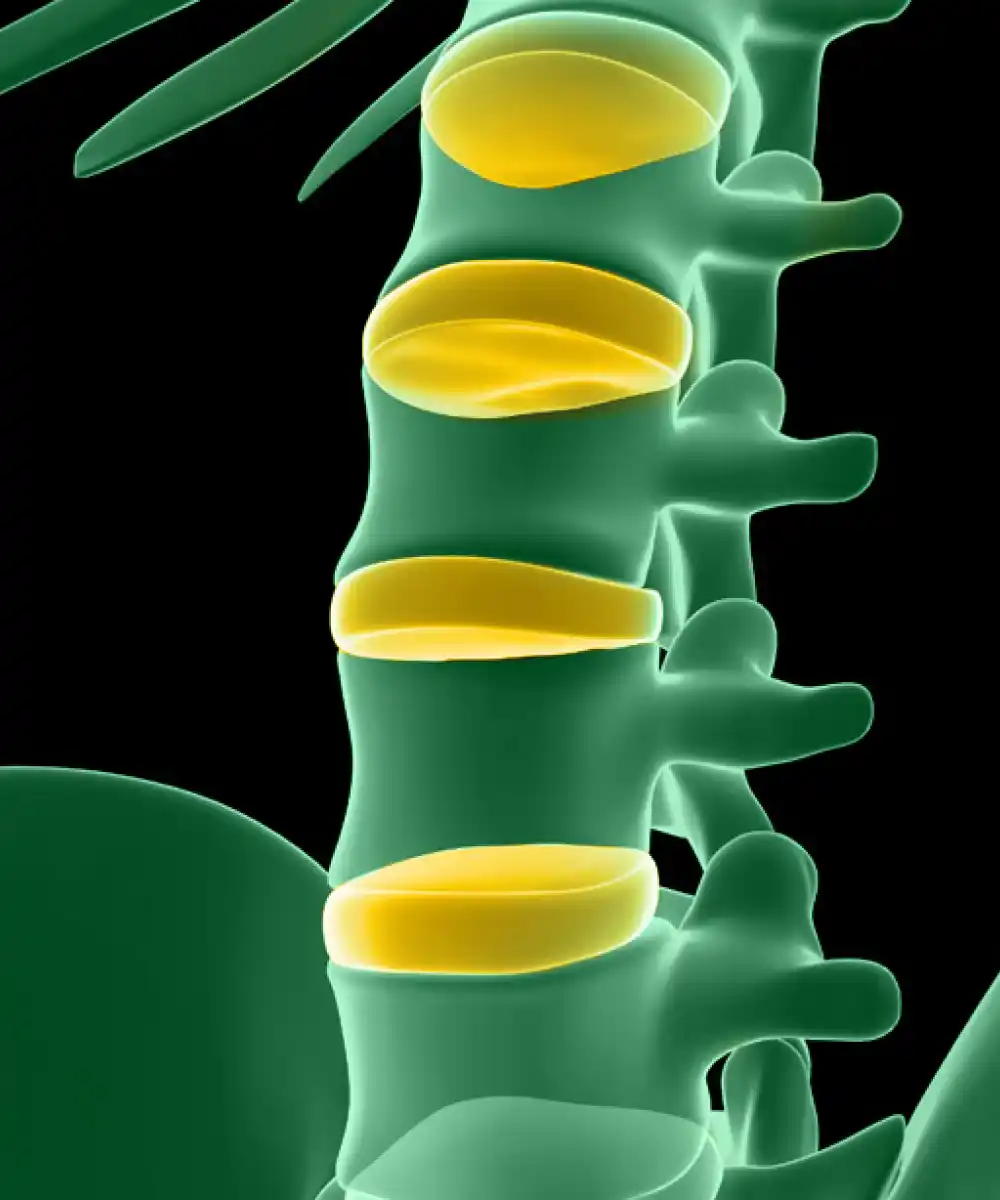 Lumbar spinal stenosis: Treatment & Diagnosis