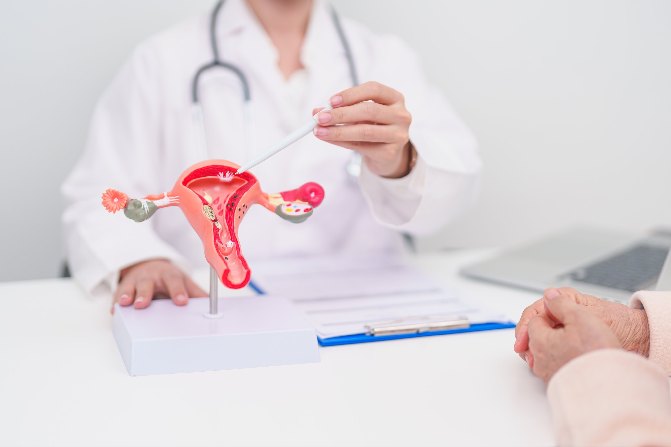 Woman patient consulting doctor with anatomy Uterus and Ovaries