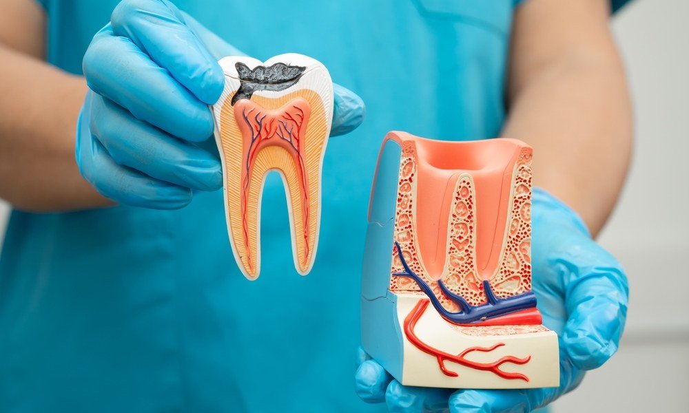 temporary-tooth-fillings.jpeg