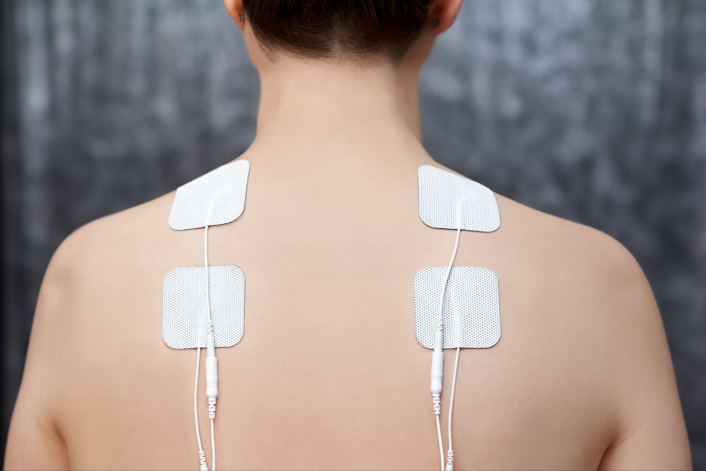TENS therapy in fibromyalgia