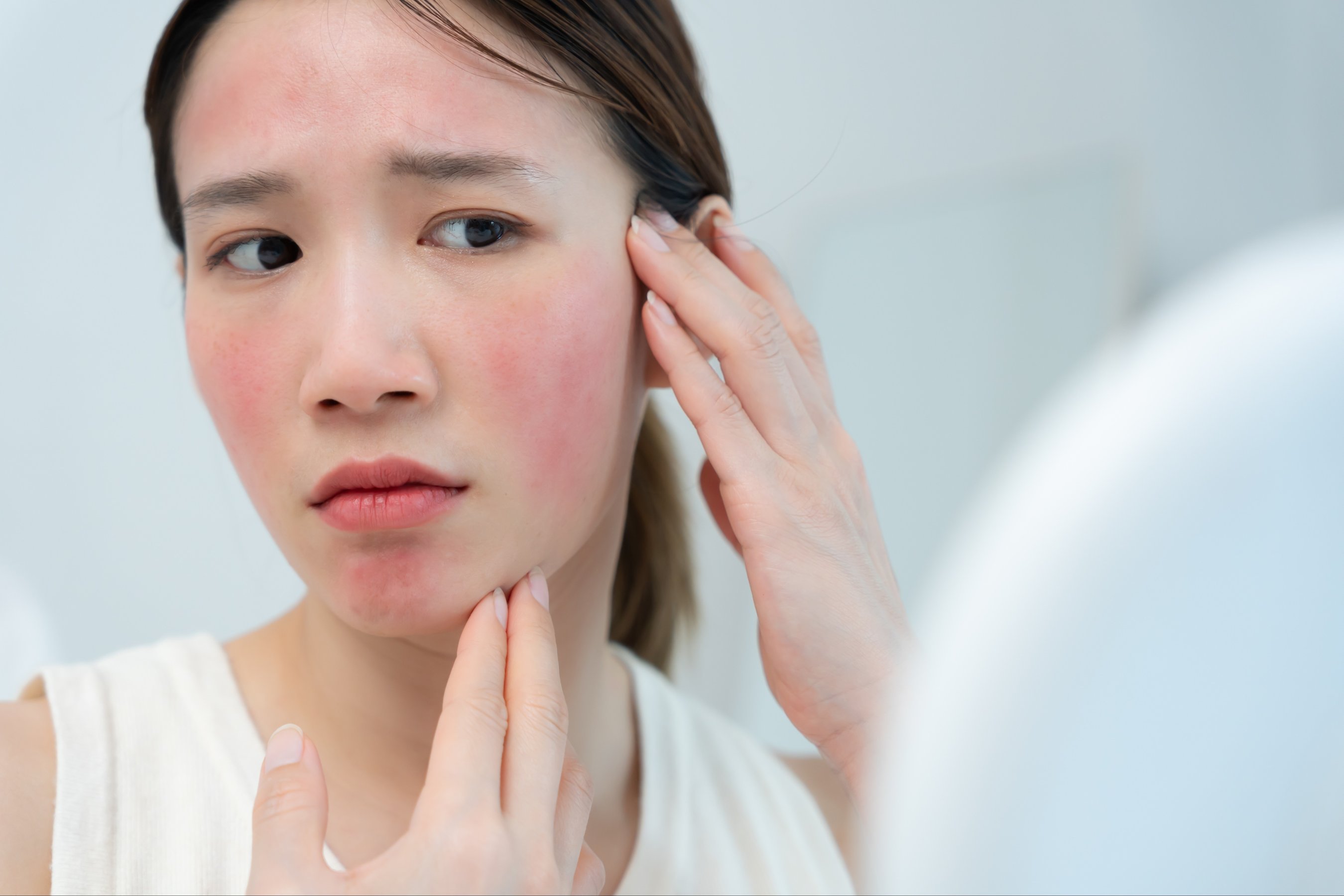 woman asian are worried about faces Dermatology and allergic