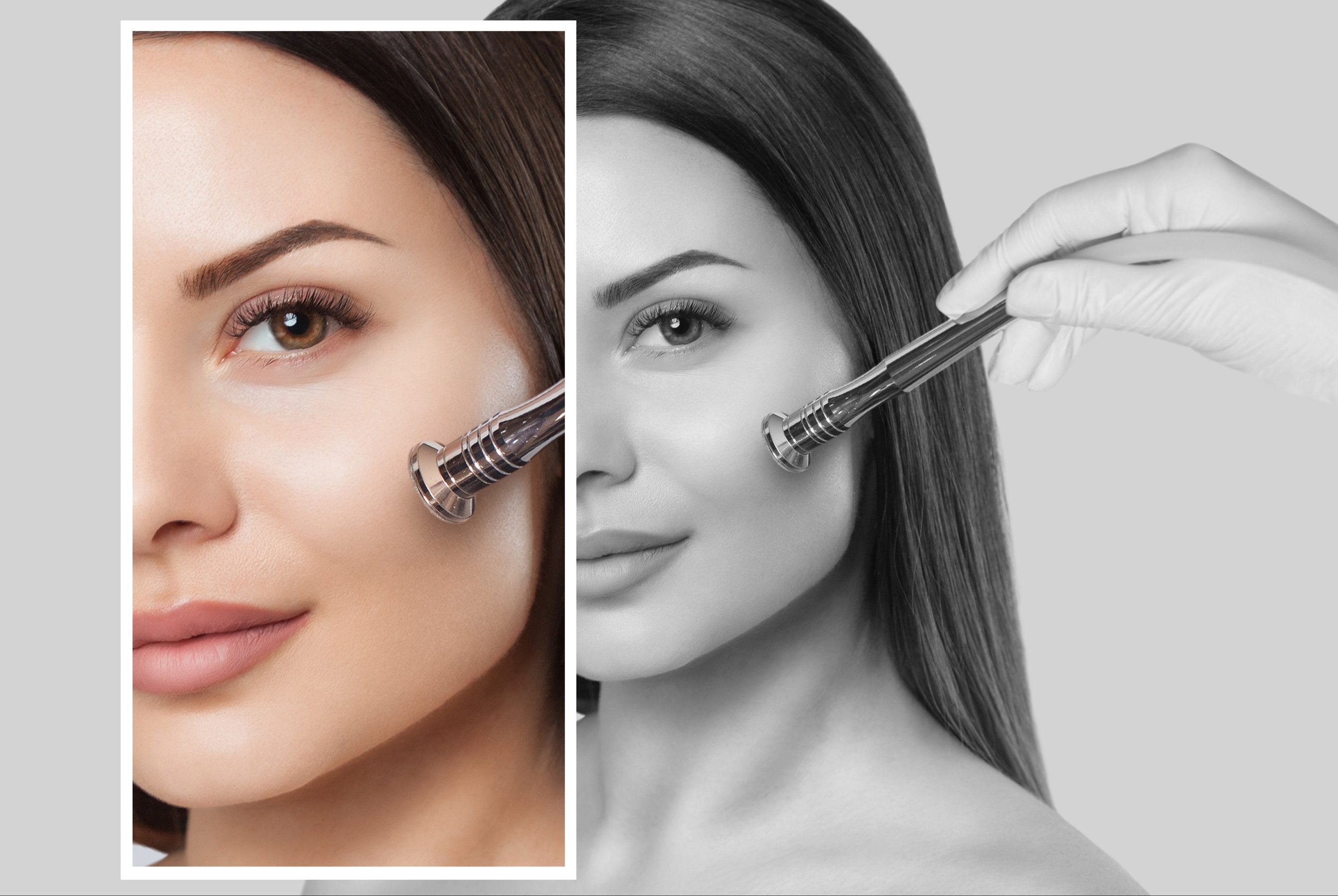 The cosmetologist makes the procedure Microdermabrasion