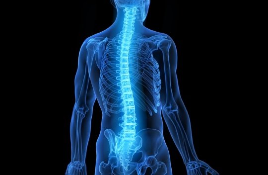Spinal Cord Stimiulation
