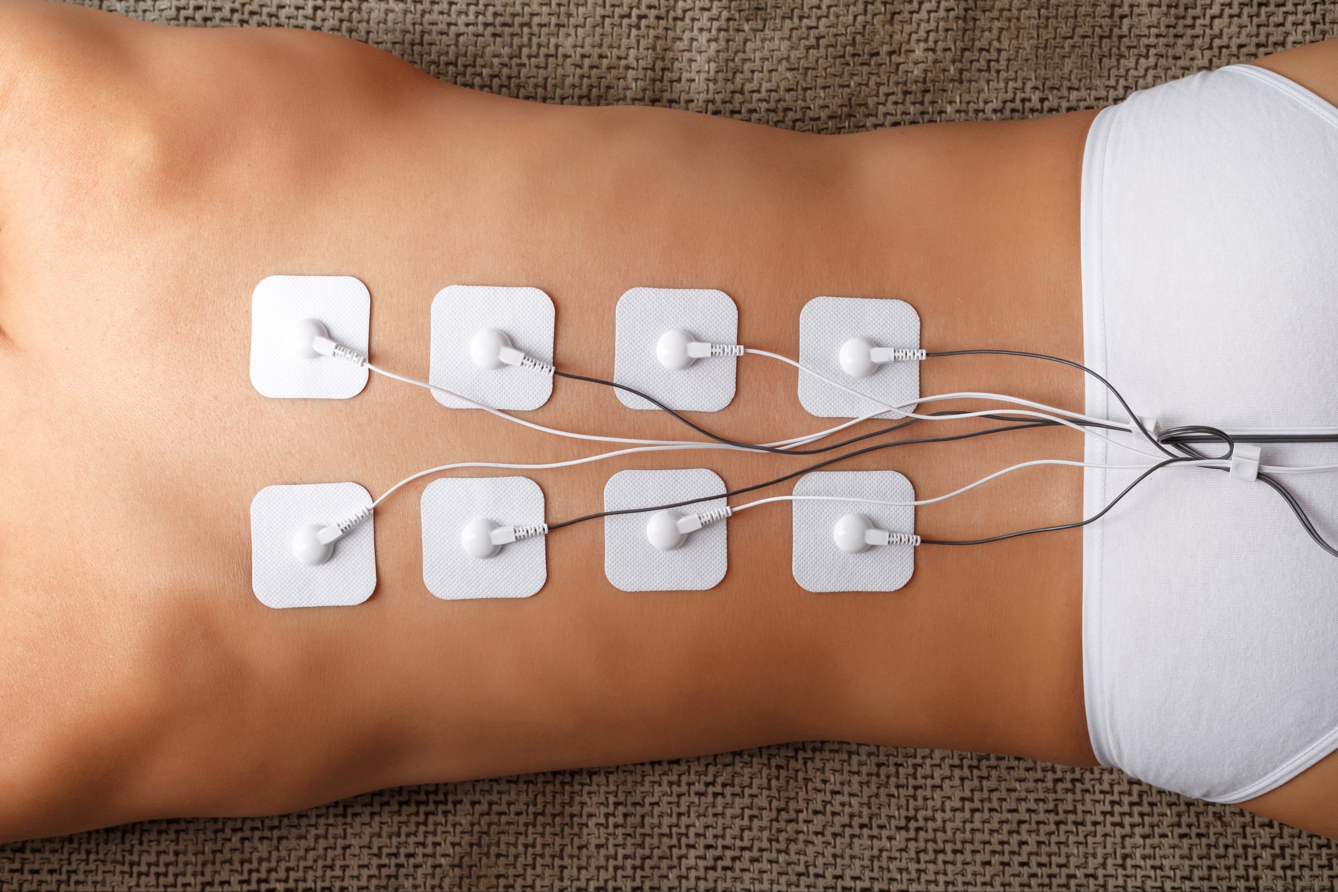 Myostimulation procedure on the back