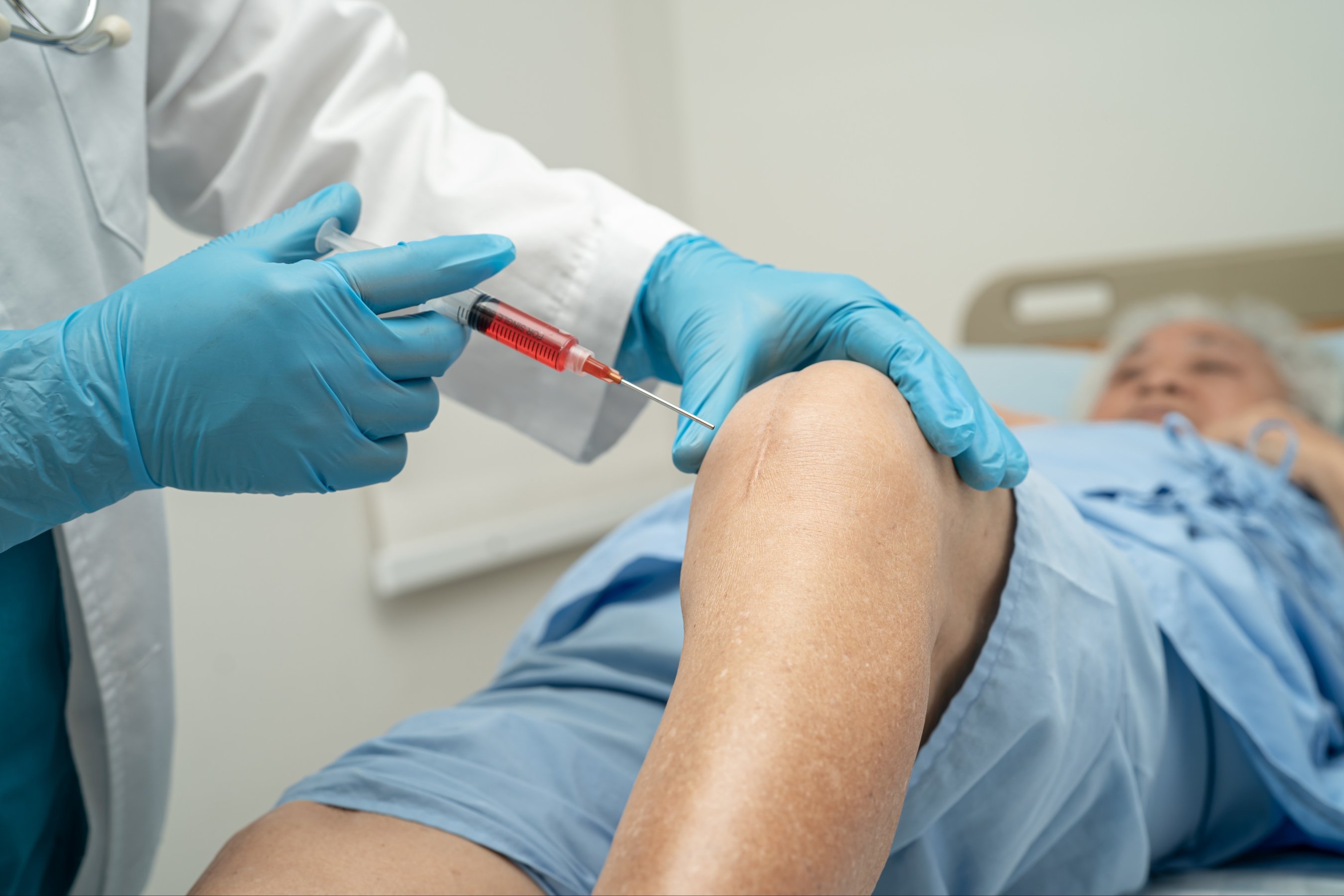doctor inject Hyaluronic acid platelet rich plasma into the knee of senior woman