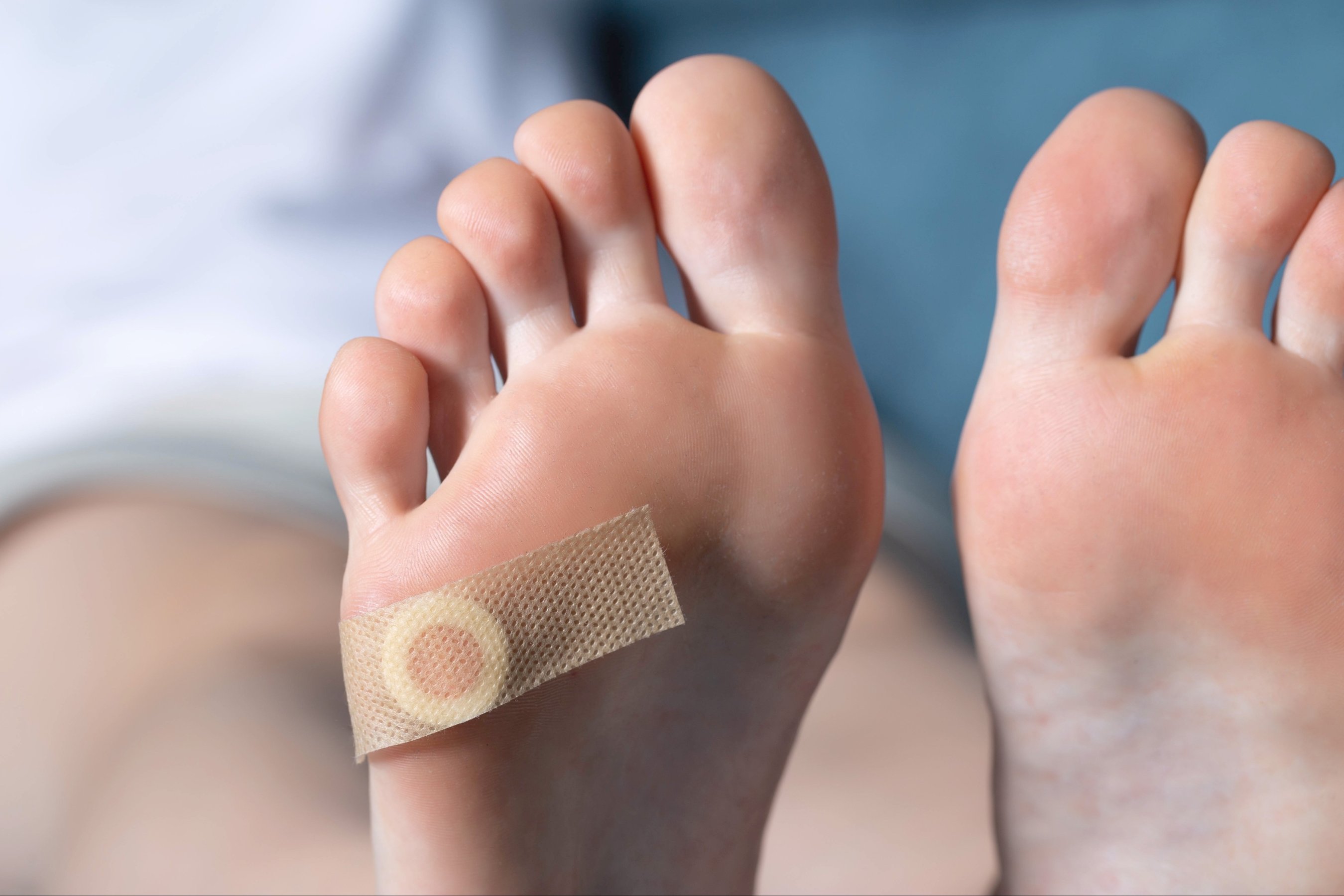 Woman foot with glued medical plaster for plantar wart