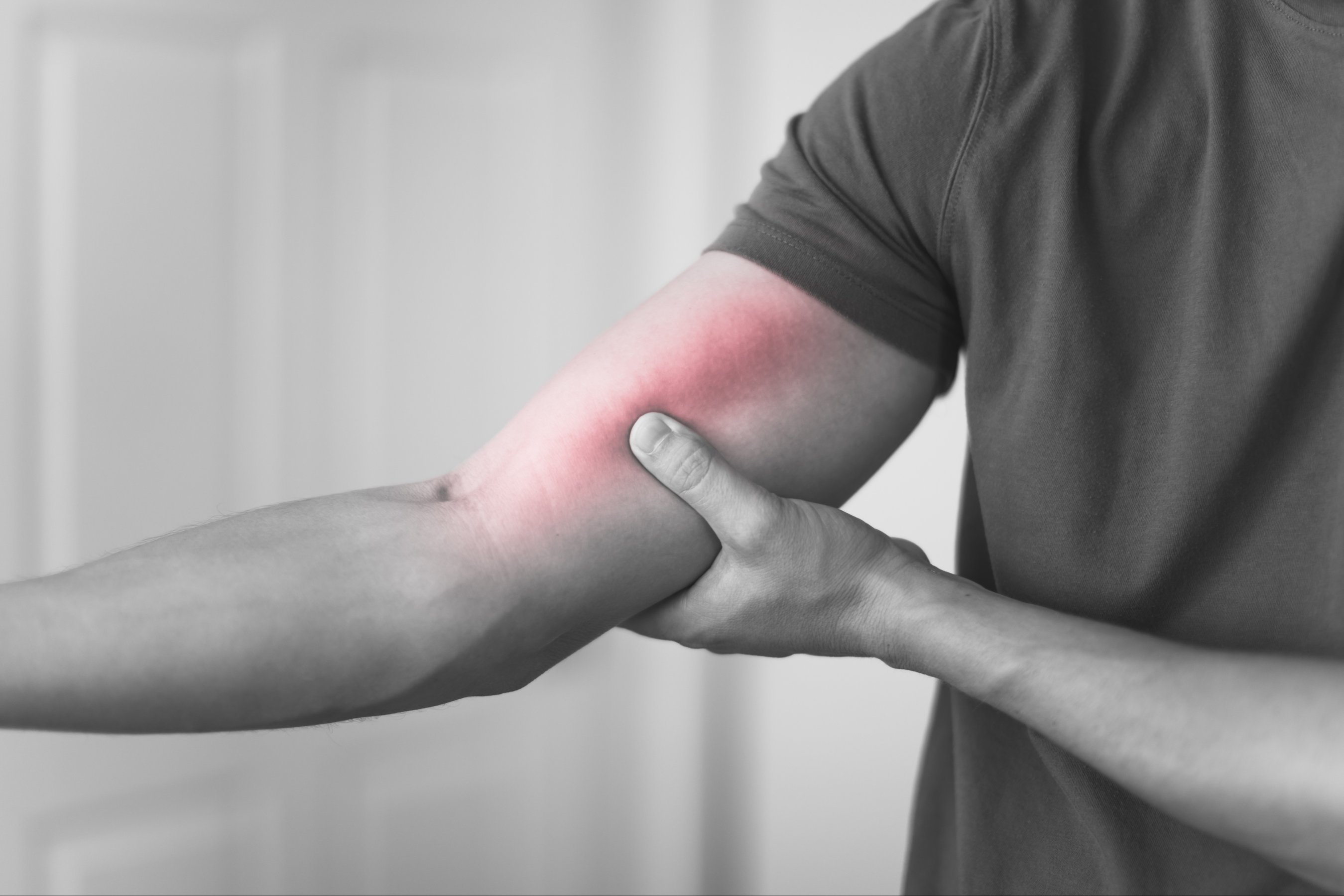 Pain in the arm bicep caused by bruising or injuring muscles