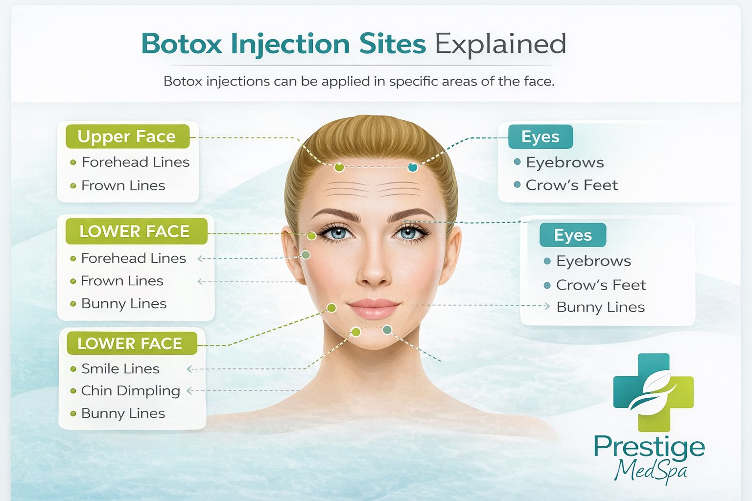 Explore common Botox injection sites and learn where Botox can be used on the face to treat wrinkles, crow’s feet, and forehead lines.