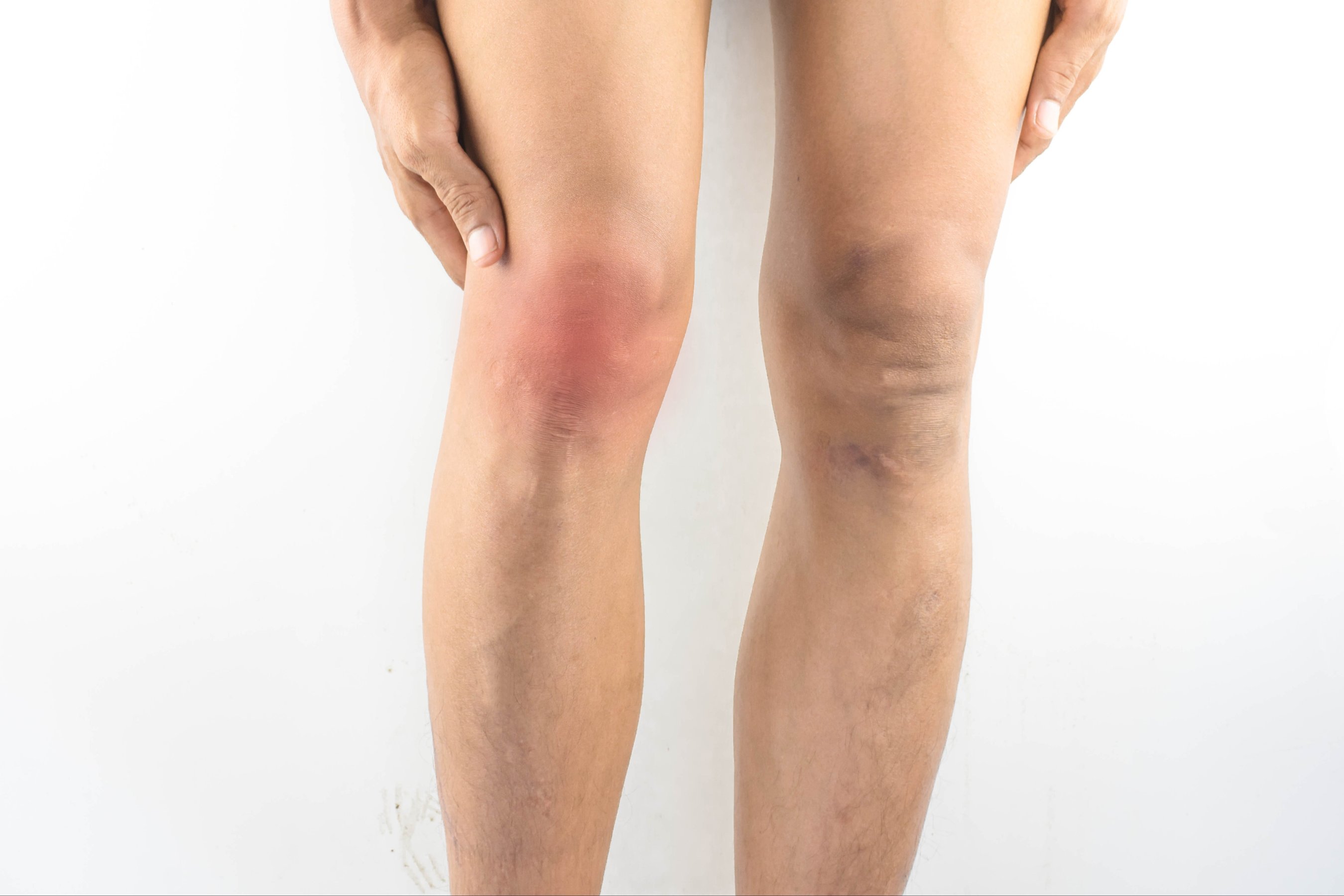 hand holding knee is injured because pain