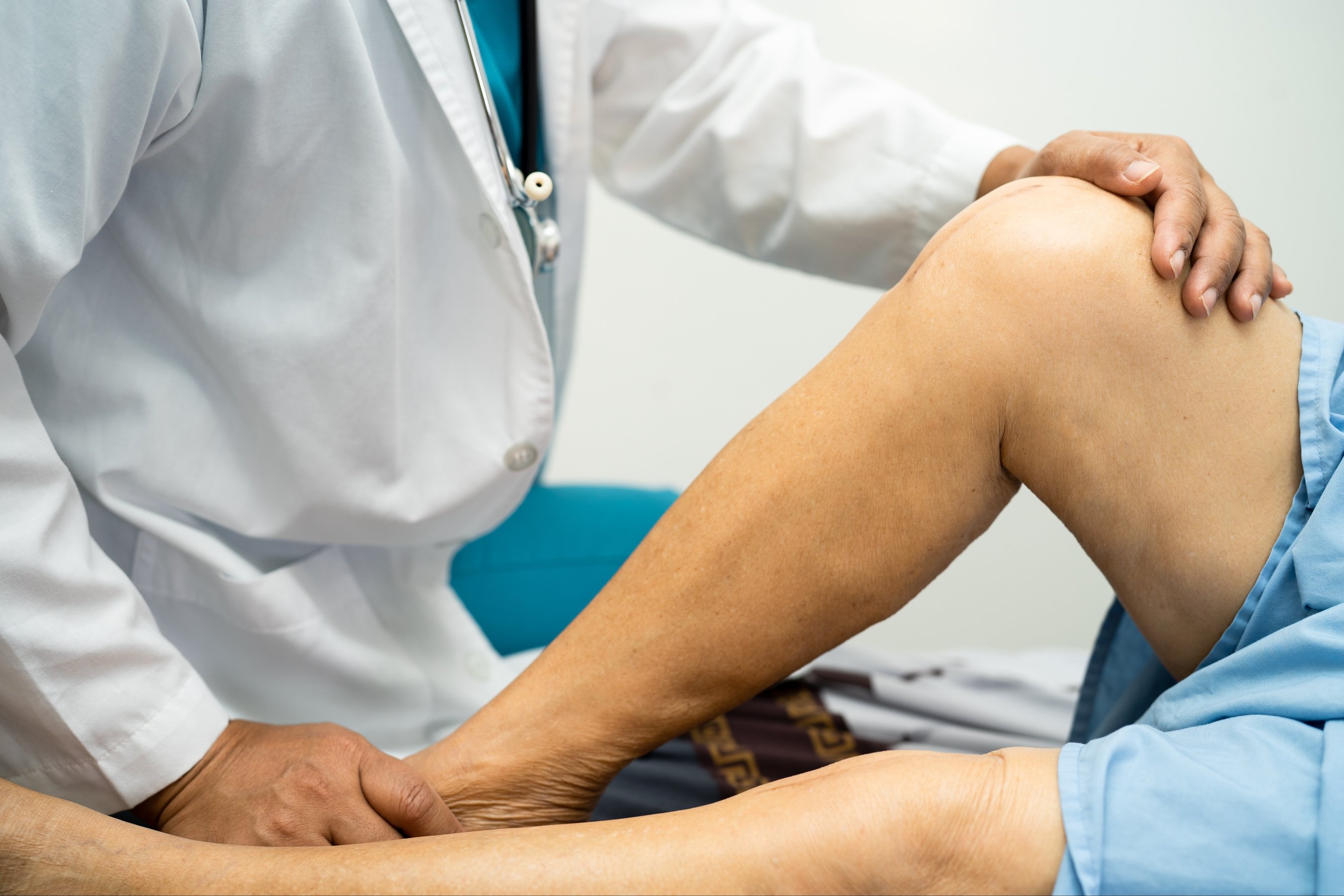 elderly woman patient show her scars surgical total knee joint replacement