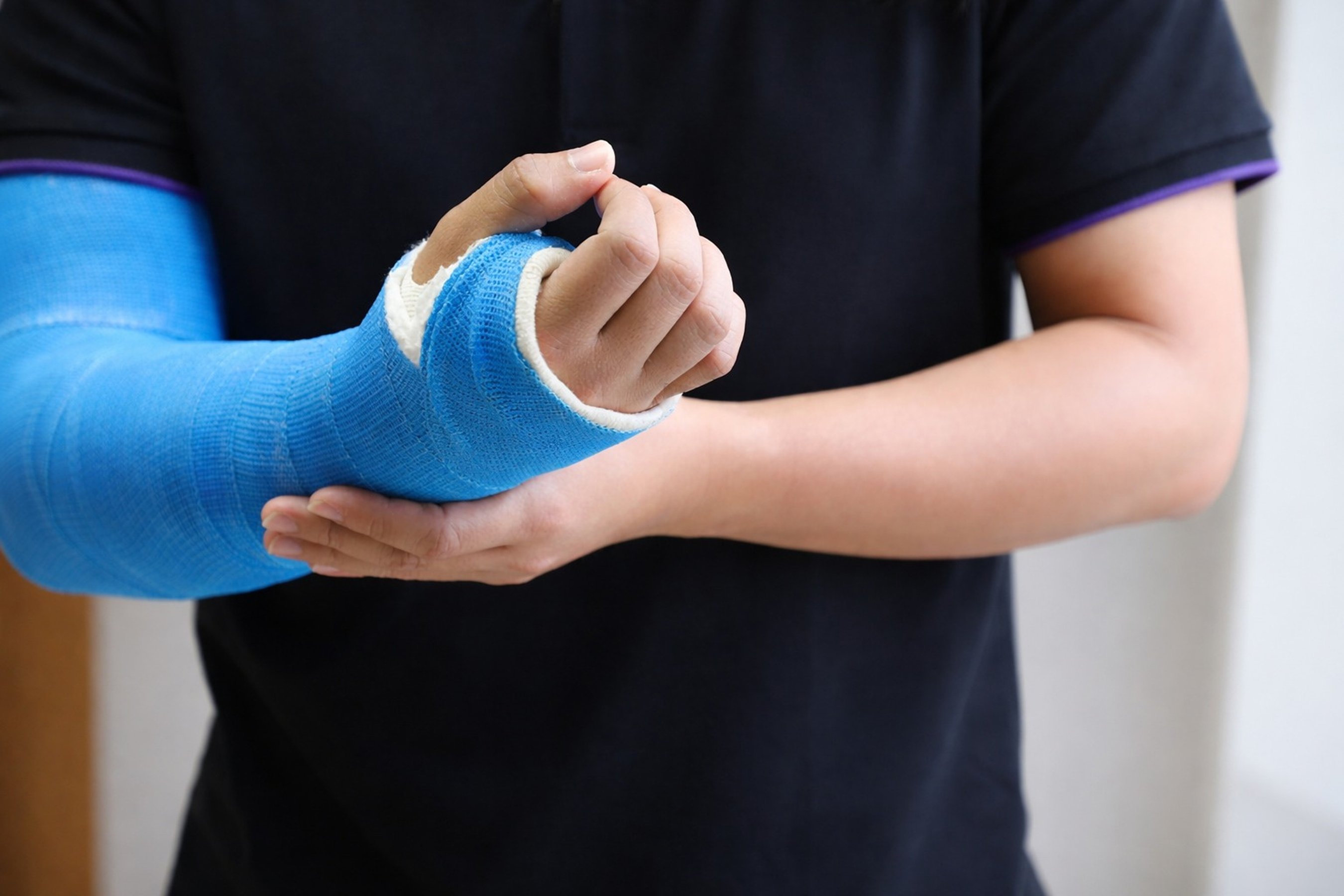 man arm with long arm plaster