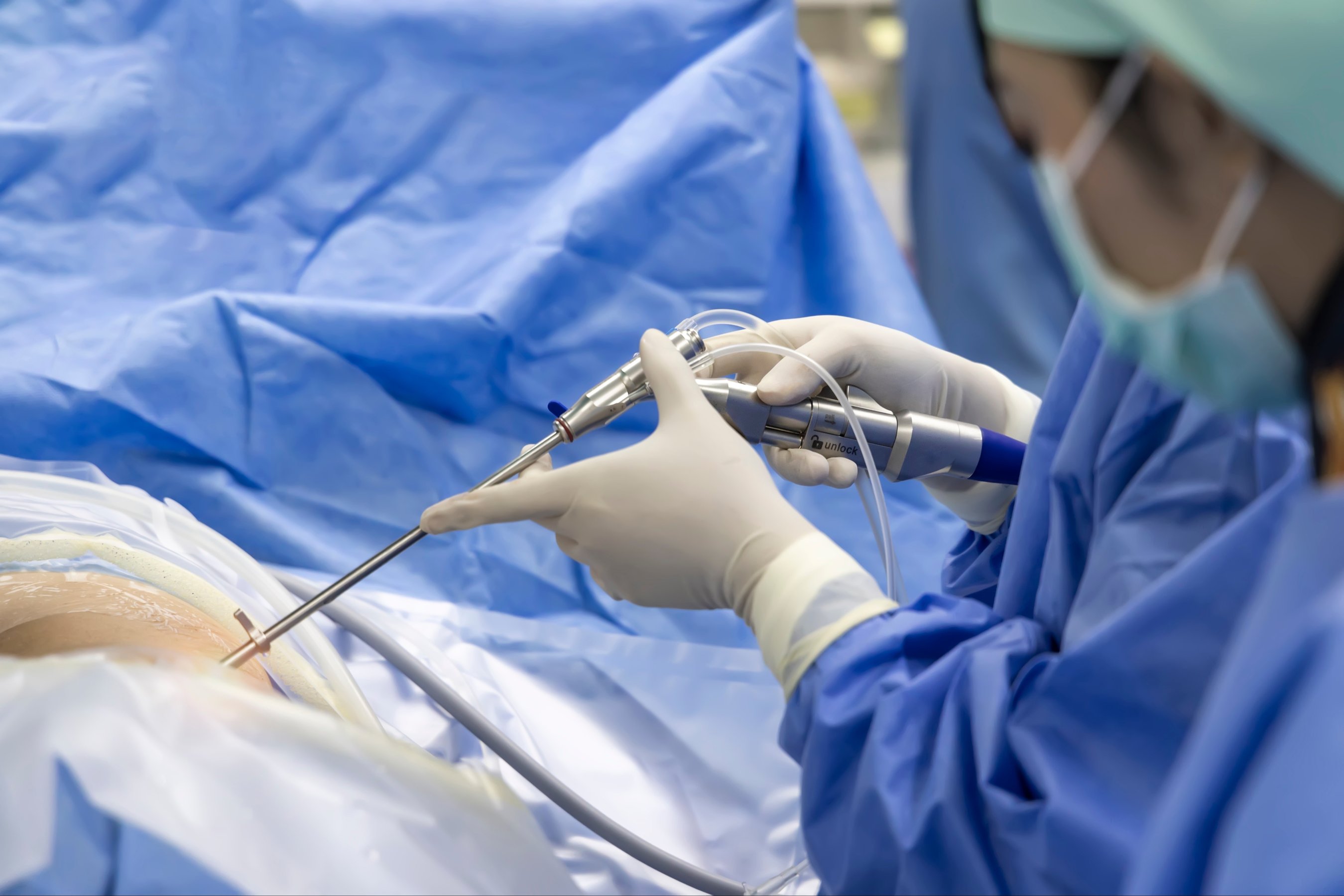 minimal invasive spine surgery technology with medical instrument