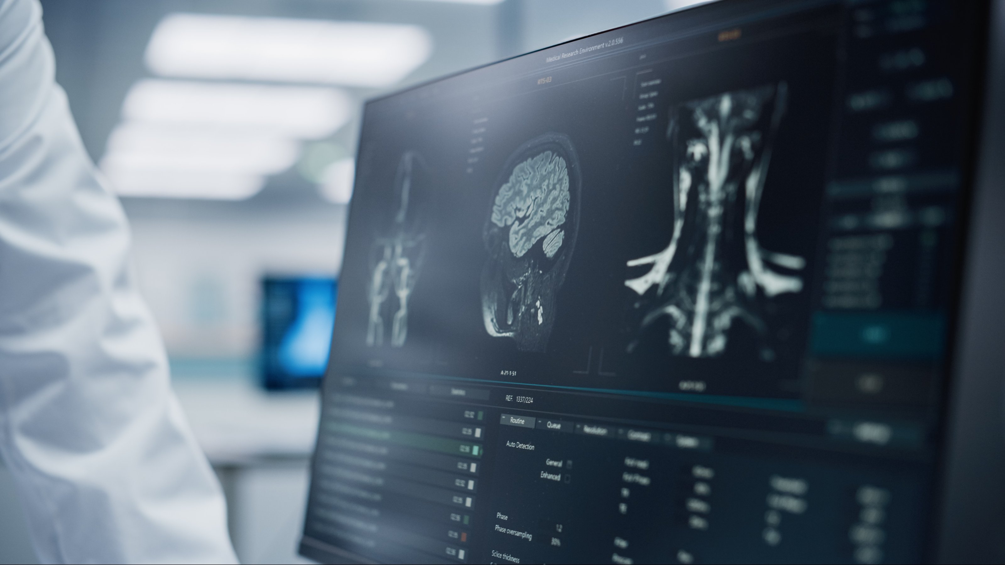 Analyse Patient MRI Scan