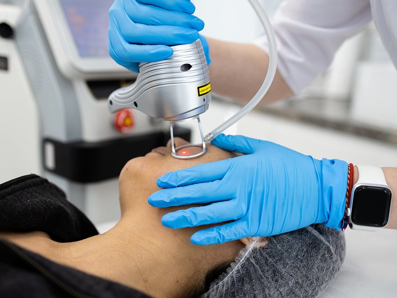 Arctic ProFractional Laser