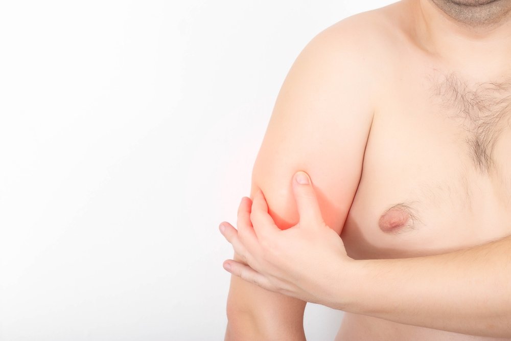 A man holding the front of his elbow after a biceps tendon injury